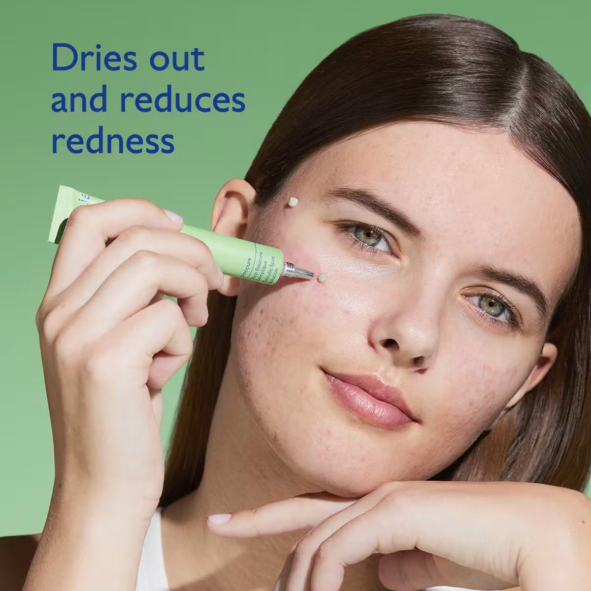 Vinopure Salicylic Spot Solution 15ml