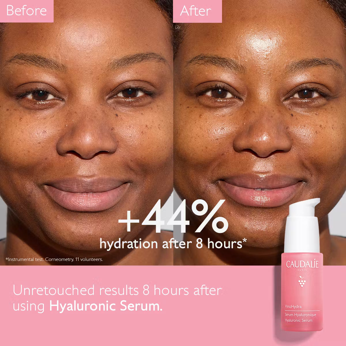 VinoHydra S.O.S Hyaluronic Acid Serum 30ml