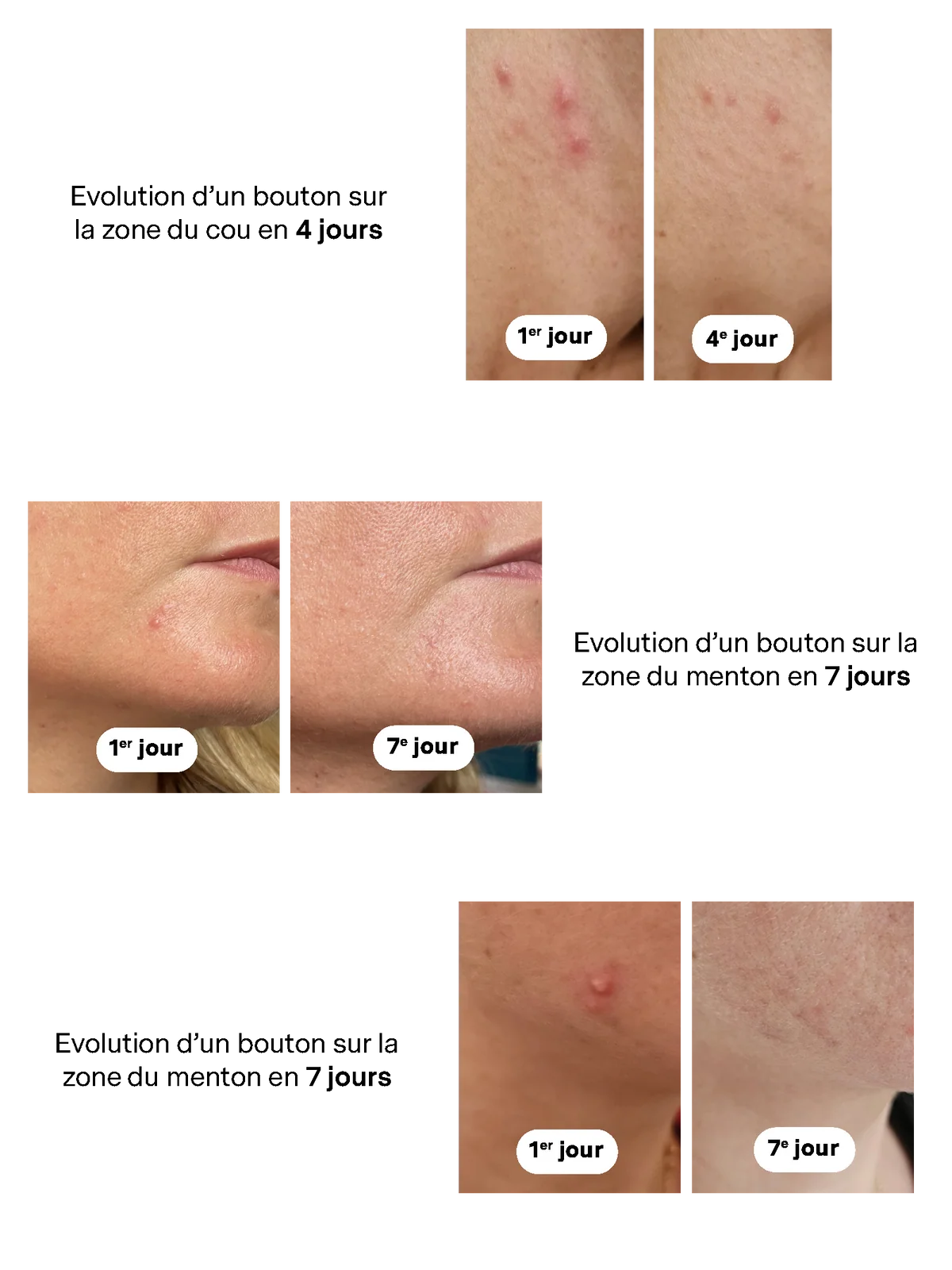 Targeted Blemish Treatment 12ml